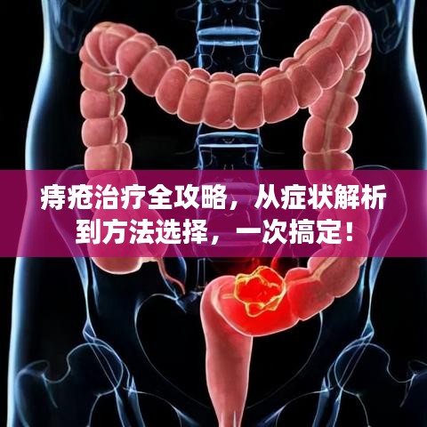 痔疮治疗全攻略，从症状解析到方法选择，一次搞定！